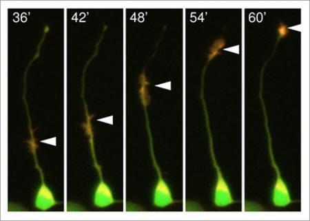 Novel protein transport mechanism for axon outgrowth (July 17, 2015)