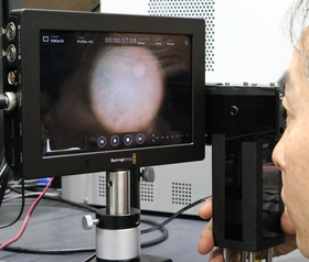 Fundus image taken by portable near-infrared fundus camera