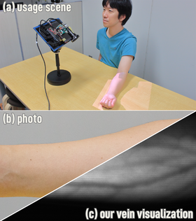 Overview of the method. Usage scene of the device to capture the vein in the