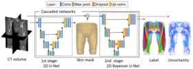 Muscle segmentation from CT volume using Bayesian U-net. Skin mask is obtained using conventional U-net during the first stage, and then Bayesian U-net is utilized to assign a muscle label as well as uncertainty to each pixel. 