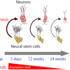 Understanding the Epigenetic Mechanisms Behind Premature Aging of the Brain