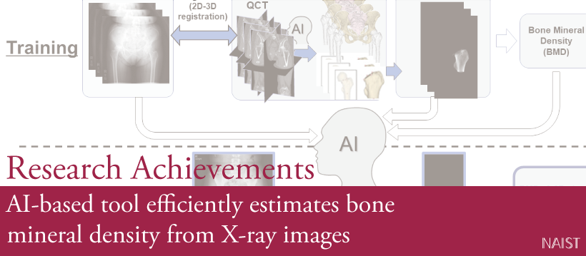 AI-based tool efficiently estimates bone mineral density from X-ray images