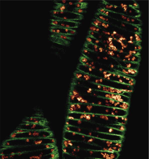 Confocal image of plant cells developing patterned secondary cell walls
