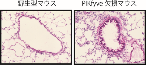 〔プレスリリース〕喘息から身体を守る仕組みが明らかに ～肺胞マクロファージ分化に必須の酵素を発見～