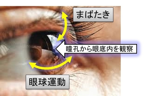 〔プレスリリース〕ぶれない、まぶしくない、自撮りできる小型眼底カメラシステムを開発 ～毛細血管もとらえる眼底網膜像で在宅ヘルスケア応用に期待～