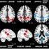 〔プレスリリース〕可視化された自身の脳活動を制御する能力の個人差を 安静状態の脳情報から予測する手法を開発