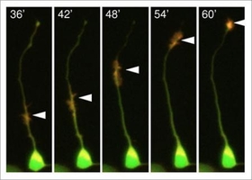 Fig.1 Actin waves transported along an axon (arrowheads).