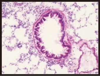 Regulatory roles for allergic inflammation in lung (May 29, 2017)