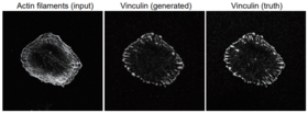 An example of a generated image of focal adhesion protein (vinculin) (center), which anchors actin filaments, from an image of actin filaments (left). The true vinculin image is also shown (right).