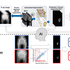 AI-based tool efficiently estimates bone mineral density from X-ray images