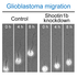 Identifying the Interactions That Drive Cell Migration in Brain Cancer