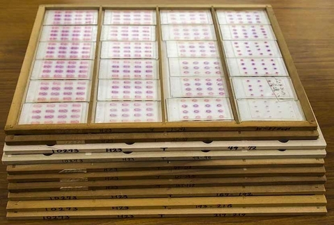 〔プレスリリース〕複数のスライスされた標本から、元の立体形状を復元する 画像処理技術を開発 ～ヒトの成長過程の解明にも寄与～