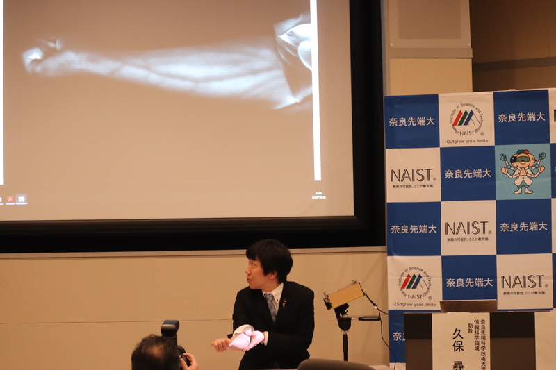 〔プレスリリース〕皮下の血管の様子を非接触・リアルタイムで鮮明に可視化 レーザー照射とカメラ撮影の僅かなギャップで散乱光をキャッチ ~注射・採血、診断などの医療応用に期待~