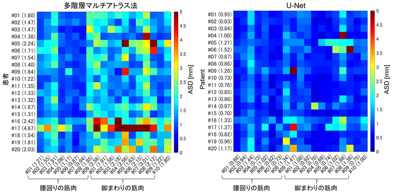 〔プレスリリース〕深層学習によるCT画像からの筋肉自動認識システムを開発 解析時間を大幅短縮、実用精度を達成 ～医学やスポーツ科学への応用期待～