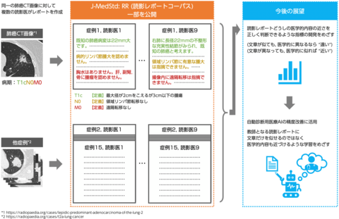 〔プレスリリース〕画像診断結果の自動作成を支援する医師の読影レポートを集積して公開 ～AIを導入した医療診断の研究を加速～