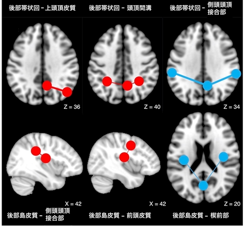 〔プレスリリース〕可視化された自身の脳活動を制御する能力の個人差を 安静状態の脳情報から予測する手法を開発