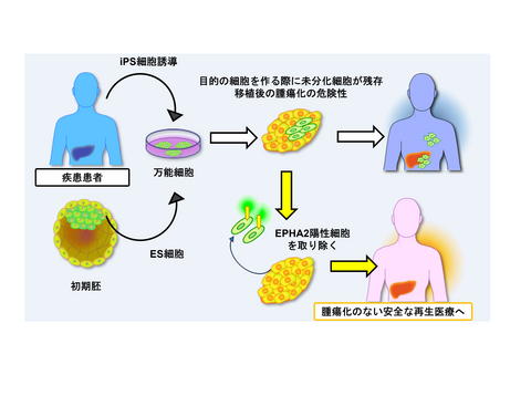 【プレスリリース】移植後の腫瘍形成を阻止できるiPS細胞の新たな重要因子を発見 ～残存する未分化iPS細胞を除去し、再生医療で懸念される 腫瘍化のリスクを減らす技術開発が可能に～