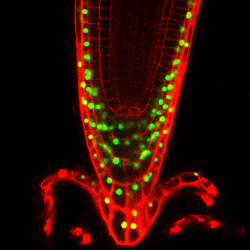 根冠分化のマスター制御因子を顕微鏡で見た写真（緑色の蛍光）。根冠は自ら剥れるという特異な性質で根の先端を守っている