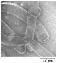 F-BARドメインによって一定の直径に形作られた人工脂質膜の電子顕微鏡像
