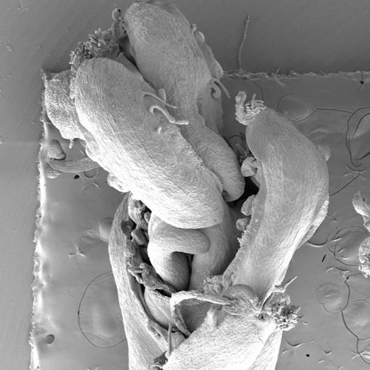 雌しべの電子顕微鏡の図
